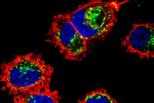 Les exosomes sont sous surveillance...