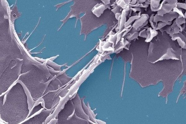 Dans un contexte tuberculeux, le VIH-1 passe d’une cellule à l’autre grâce à des nanotubes formés entre les macrophages, ce qui augmente très fortement la proportion de cellules infectées