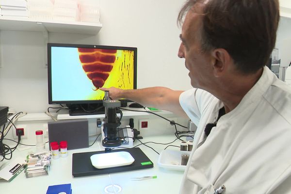 A l'IHU de Marseille, Jean-Michel Bérenger élève les punaises de lit et les passe au microscope. Sur cette image, il montre comment la sexualité débridée du mâle engendre prolifération et résistance aux insecticides.