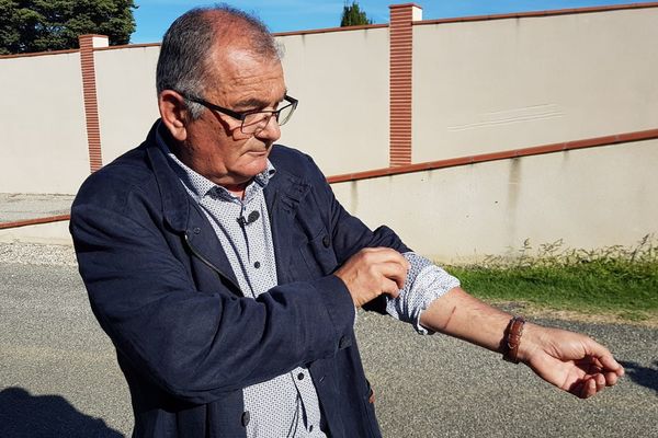 Francis Boy, le maire de Saint-Ybars, en Ariège, a été touché à l'avant bras par la lame d'un couteau