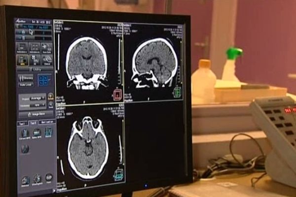 L'imagerie médicale permet d'établir le diagnostic