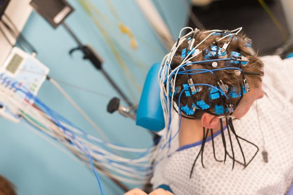 Un patient passe un électroencéphalogramme.